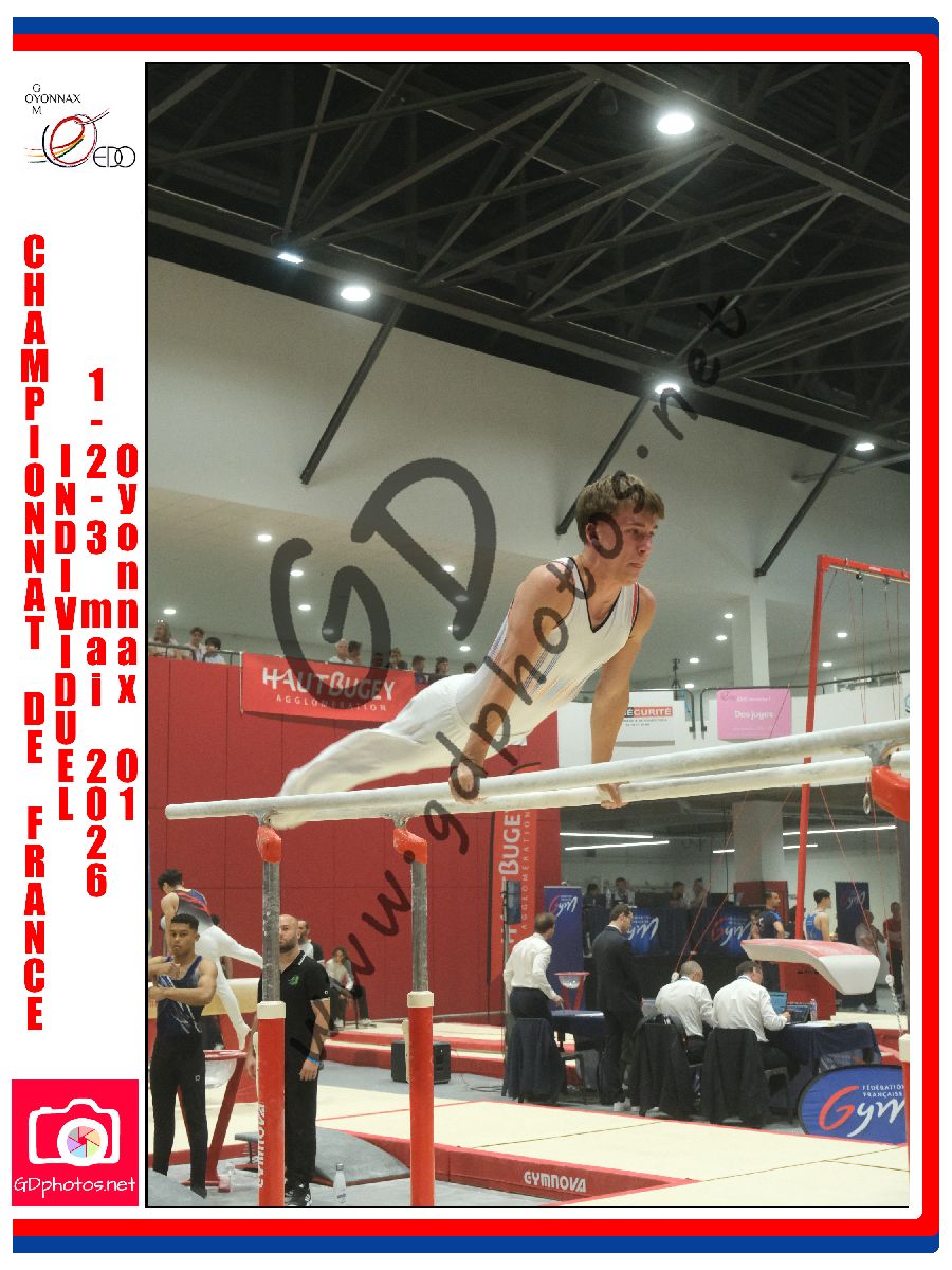 5320931