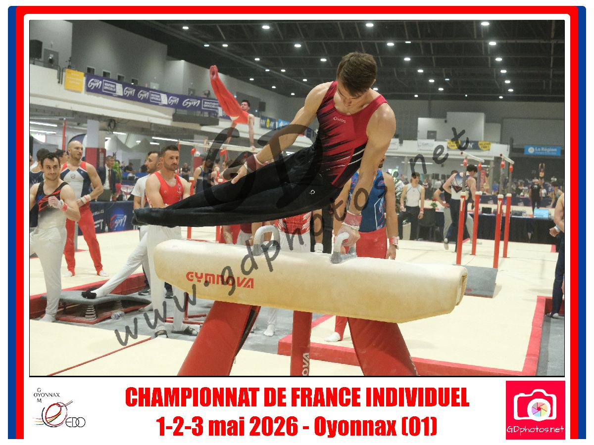 5329278