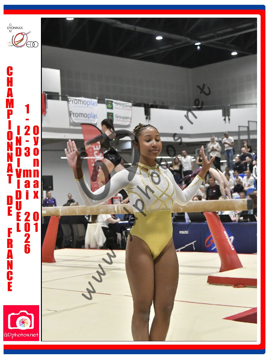 5335539