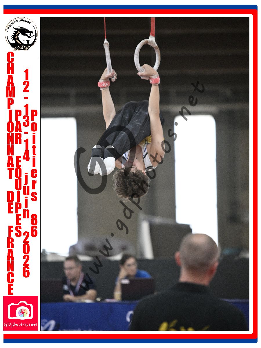 5417000
